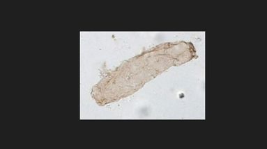 Image montrant un spécimen de microfossile de Navifusa majensis, un type présumé de cyanobactérie.