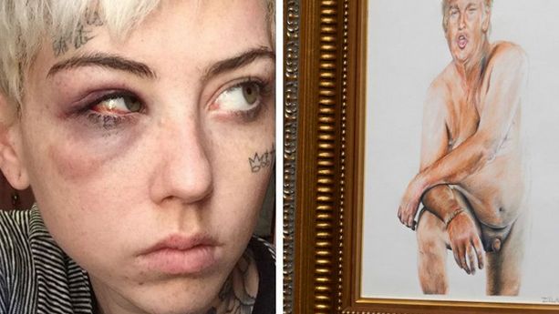 PHOTOS - L’artiste qui a peint le micro-pénis de Donald Trump affirme avoir été tabassée par l'un de ses partisans